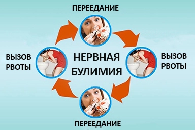 Лечение булимии в Фрязино